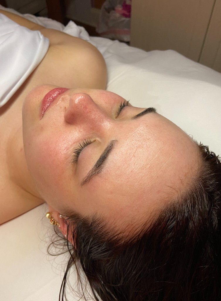 Skin after a customized facial treatment, refreshed, hydrated look