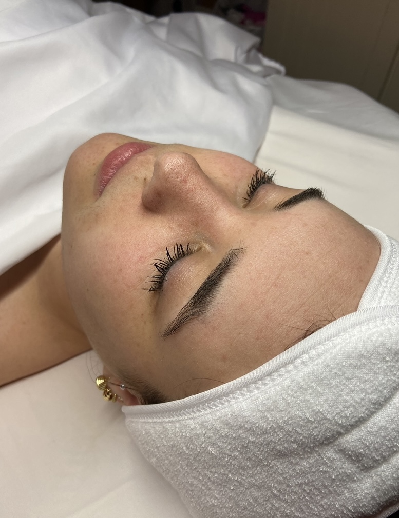 Skin before customized facial treatment