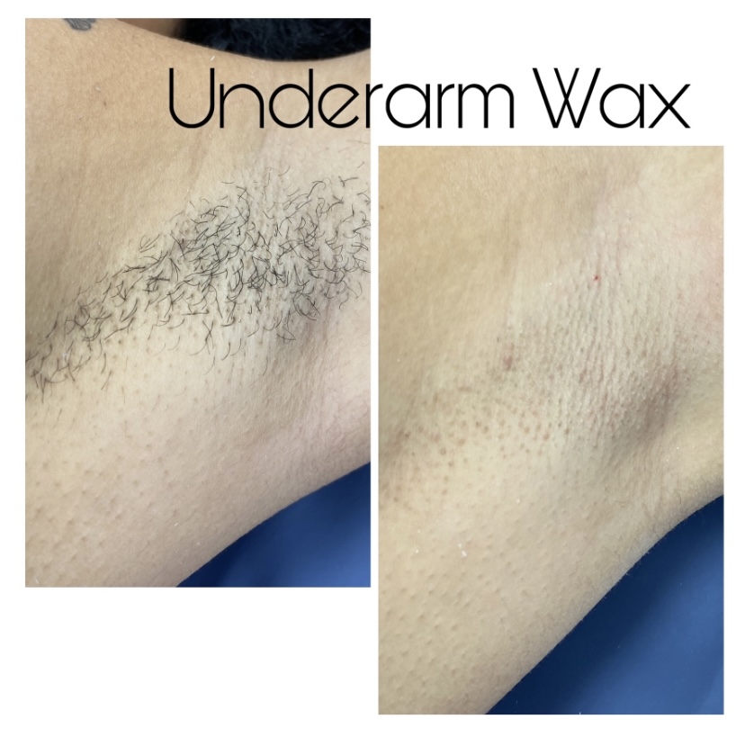 Before and after underarm wax, smooth skin after hair removal